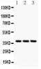 C-X-C Motif Chemokine Receptor 6 antibody, LS-C313200, Lifespan Biosciences, Western Blot image 