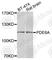 Phosphodiesterase 6A antibody, A7915, ABclonal Technology, Western Blot image 