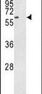 Receptor Like Tyrosine Kinase antibody, PA5-14734, Invitrogen Antibodies, Western Blot image 