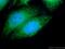 Phosphatidylinositol Glycan Anchor Biosynthesis Class S antibody, 18334-1-AP, Proteintech Group, Immunofluorescence image 