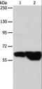 G Protein-Coupled Receptor Kinase 4 antibody, LS-C404030, Lifespan Biosciences, Western Blot image 