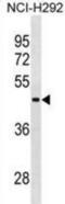 RNA Binding Motif Protein, Y-Linked, Family 1, Member A1 antibody, abx025047, Abbexa, Western Blot image 