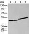 IL-9 receptor antibody, PA5-67619, Invitrogen Antibodies, Western Blot image 