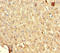 Signal Recognition Particle 19 antibody, LS-C317808, Lifespan Biosciences, Immunohistochemistry paraffin image 