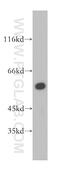Hydroxymethylglutaryl-CoA synthase, cytoplasmic antibody, 17643-1-AP, Proteintech Group, Western Blot image 