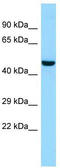 Lipase Family Member N antibody, TA331210, Origene, Western Blot image 