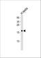 SPANX Family Member A2 antibody, A16670, Boster Biological Technology, Western Blot image 