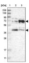 Butyrophilin Subfamily 2 Member A1 antibody, PA5-53955, Invitrogen Antibodies, Western Blot image 