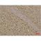 Microtubule Associated Protein 1 Light Chain 3 Beta antibody, LS-C387790, Lifespan Biosciences, Immunohistochemistry paraffin image 