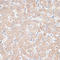 Glypican 3 antibody, LS-C749002, Lifespan Biosciences, Immunohistochemistry frozen image 