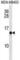 Cellular Retinoic Acid Binding Protein 2 antibody, abx028280, Abbexa, Western Blot image 
