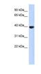 Aurora Kinase C antibody, NBP1-54994, Novus Biologicals, Western Blot image 