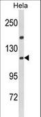 Importin 11 antibody, LS-C165263, Lifespan Biosciences, Western Blot image 