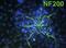 Neurofilament Heavy antibody, ab4680, Abcam, Immunofluorescence image 