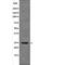 Von Hippel-Lindau Tumor Suppressor antibody, abx219320, Abbexa, Western Blot image 