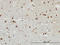 Fibroblast Growth Factor 12 antibody, LS-C133188, Lifespan Biosciences, Immunohistochemistry paraffin image 