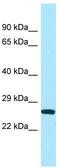 Ubiquinol-Cytochrome C Reductase Complex Assembly Factor 1 antibody, TA331239, Origene, Western Blot image 