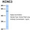 Potassium Voltage-Gated Channel Subfamily C Member 3 antibody, TA338545, Origene, Western Blot image 