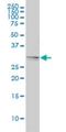 Tropomyosin 4 antibody, H00007171-M01, Novus Biologicals, Western Blot image 