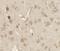 Jac antibody, LS-C201043, Lifespan Biosciences, Immunohistochemistry paraffin image 