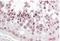 PATJ Crumbs Cell Polarity Complex Component antibody, NB100-1354, Novus Biologicals, Immunohistochemistry paraffin image 