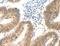 Signal-Induced Proliferation-Associated 1 antibody, MBS2521272, MyBioSource, Immunohistochemistry paraffin image 