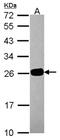 Pseudouridine 5'-Phosphatase antibody, NBP2-14971, Novus Biologicals, Western Blot image 