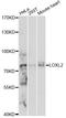 Lysyl Oxidase Like 2 antibody, LS-C749633, Lifespan Biosciences, Western Blot image 