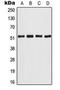 Activating Transcription Factor 2 antibody, orb216068, Biorbyt, Western Blot image 