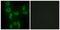Isoleucyl-TRNA Synthetase 2, Mitochondrial antibody, PA5-49566, Invitrogen Antibodies, Immunofluorescence image 