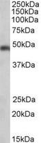 SEC61 Translocon Alpha 1 Subunit antibody, NB100-768, Novus Biologicals, Western Blot image 