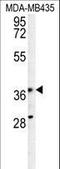 Phosphoribosyl Pyrophosphate Synthetase Associated Protein 1 antibody, LS-C165603, Lifespan Biosciences, Western Blot image 