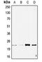 Stathmin 2 antibody, LS-C353305, Lifespan Biosciences, Western Blot image 