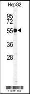 Cathepsin H antibody, 62-866, ProSci, Western Blot image 