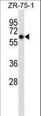 Arylsulfatase D antibody, LS-C156519, Lifespan Biosciences, Western Blot image 