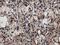 MYD88 Innate Immune Signal Transduction Adaptor antibody, M00025-3, Boster Biological Technology, Immunohistochemistry paraffin image 