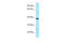 Abhydrolase Domain Containing 6 antibody, ARP65850_P050, Aviva Systems Biology, Western Blot image 