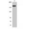 Mannose Receptor C Type 2 antibody, LS-C383344, Lifespan Biosciences, Western Blot image 