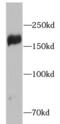 Insulin Receptor Substrate 2 antibody, FNab09769, FineTest, Western Blot image 
