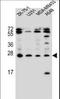 Endothelin 1 antibody, LS-C167623, Lifespan Biosciences, Western Blot image 