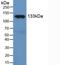 Nitric Oxide Synthase 3 antibody, LS-C295649, Lifespan Biosciences, Western Blot image 