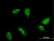 Ring Finger Protein 6 antibody, LS-C198095, Lifespan Biosciences, Immunofluorescence image 