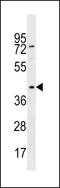 Kynurenine Aminotransferase 3 antibody, LS-C158826, Lifespan Biosciences, Western Blot image 