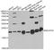 NADH:Ubiquinone Oxidoreductase Subunit S4 antibody, LS-C748565, Lifespan Biosciences, Western Blot image 