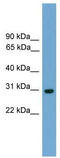 Transcription Elongation Factor A1 antibody, TA342295, Origene, Western Blot image 