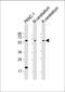 Solute Carrier Family 11 Member 2 antibody, 57-280, ProSci, Western Blot image 