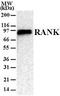 TNF Receptor Superfamily Member 11a antibody, MA5-16153, Invitrogen Antibodies, Western Blot image 