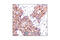 Tyrosine antibody, 9411S, Cell Signaling Technology, Immunohistochemistry paraffin image 