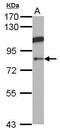 Amine Oxidase Copper Containing 1 antibody, GTX101421, GeneTex, Western Blot image 