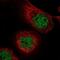 Microtubule Associated Serine/Threonine Kinase Like antibody, NBP2-55023, Novus Biologicals, Immunocytochemistry image 
